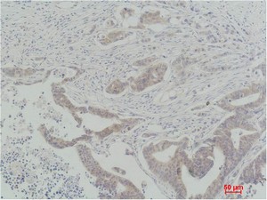 Raf-1 Polyclonal Antibody