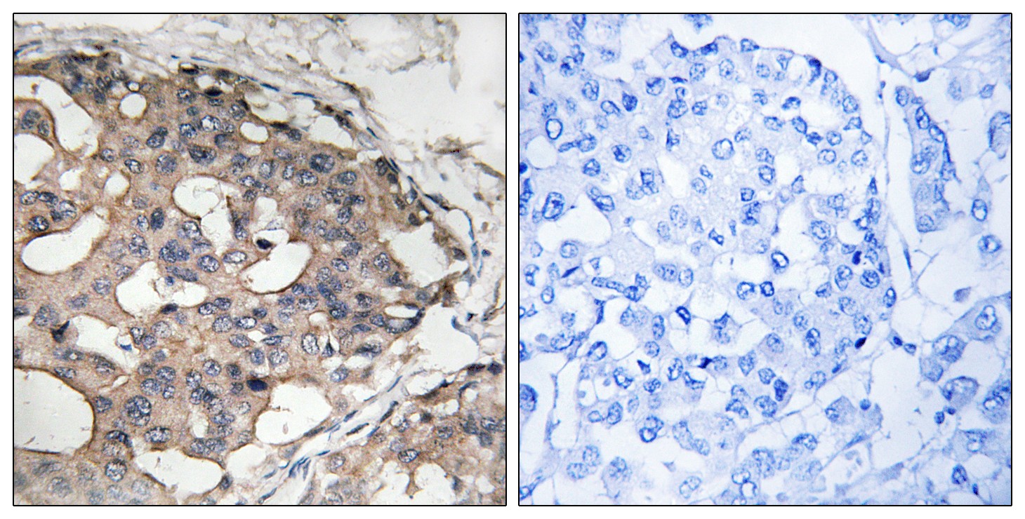 Raf-B Polyclonal Antibody