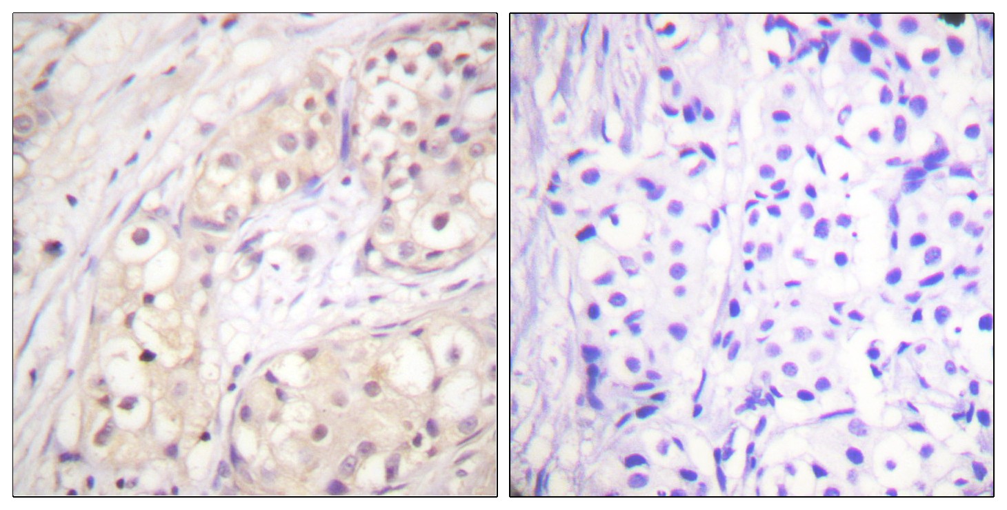 Raf-B Polyclonal Antibody