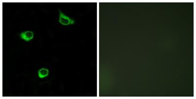 Frizzled-6 Polyclonal Antibody