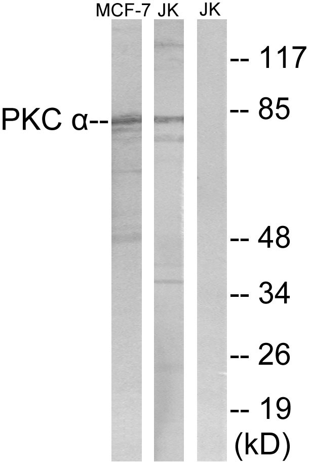 PKC α Polyclonal Antibody