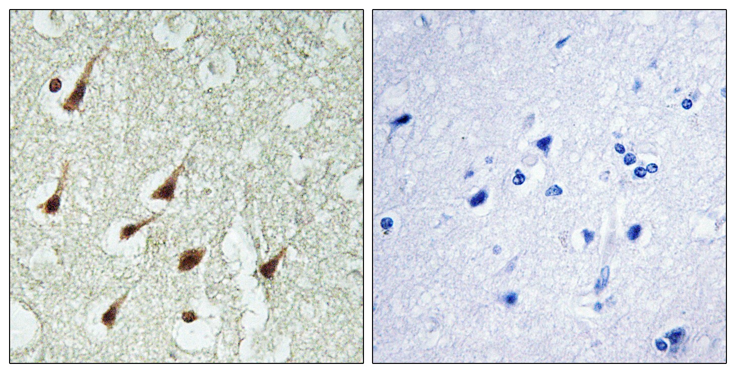 PKC θ Polyclonal Antibody