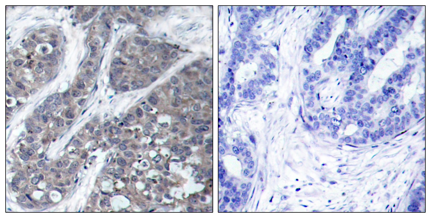 PYK2 Polyclonal Antibody