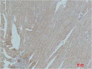 PPAR-γ Polyclonal Antibody