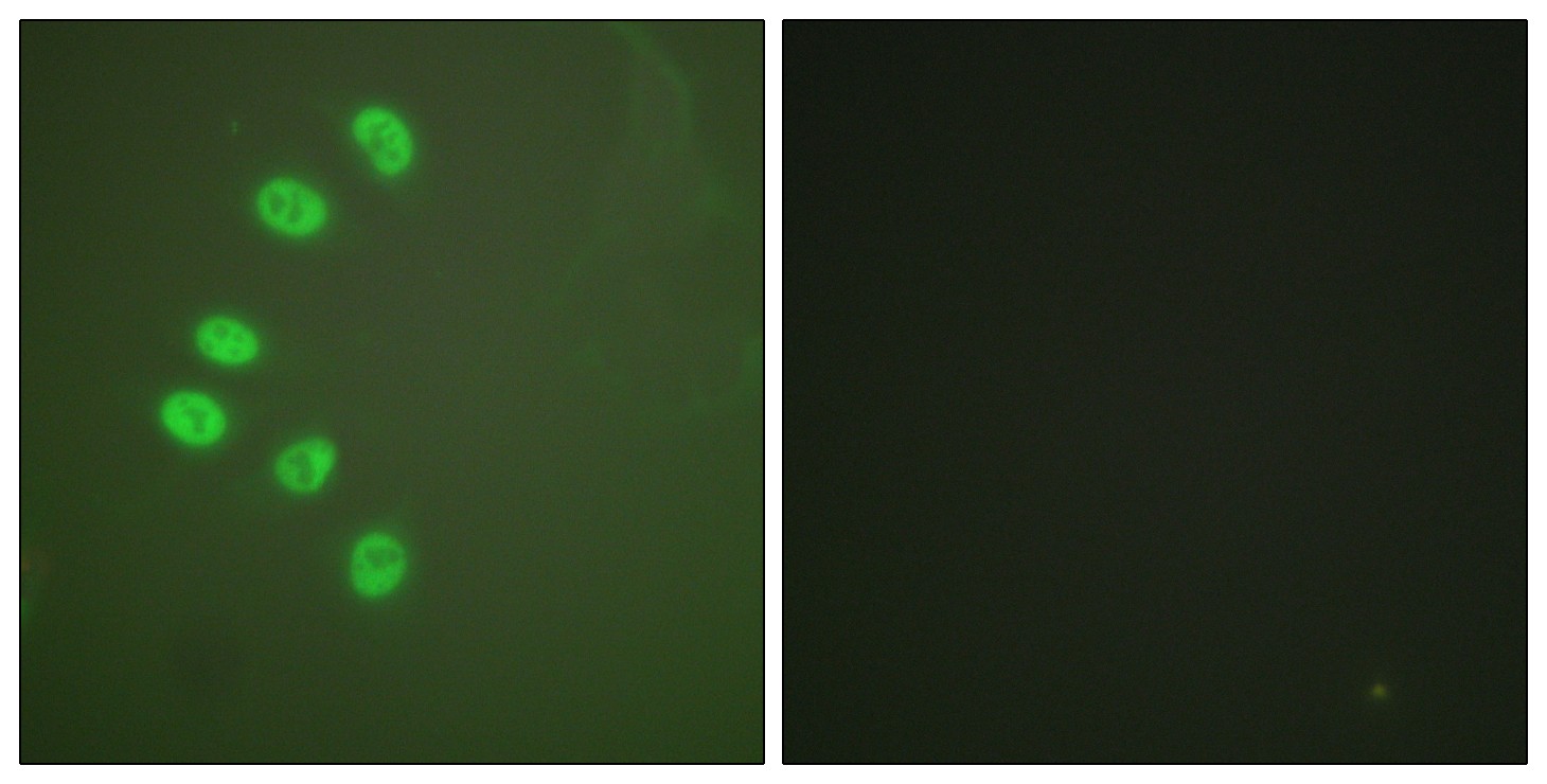 PR Polyclonal Antibody