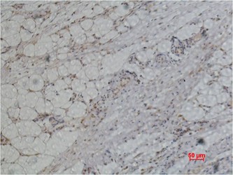 PRX I Polyclonal Antibody