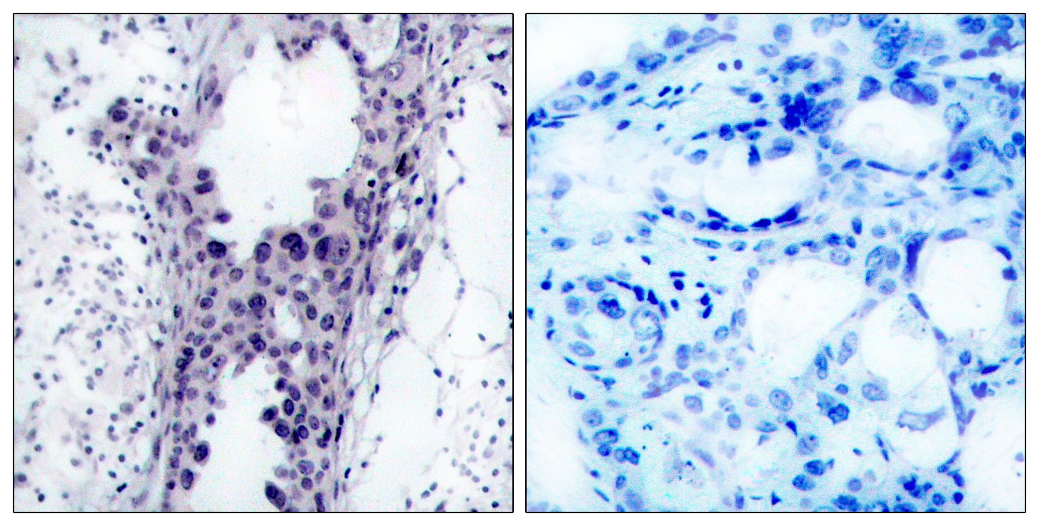 PTEN Polyclonal Antibody