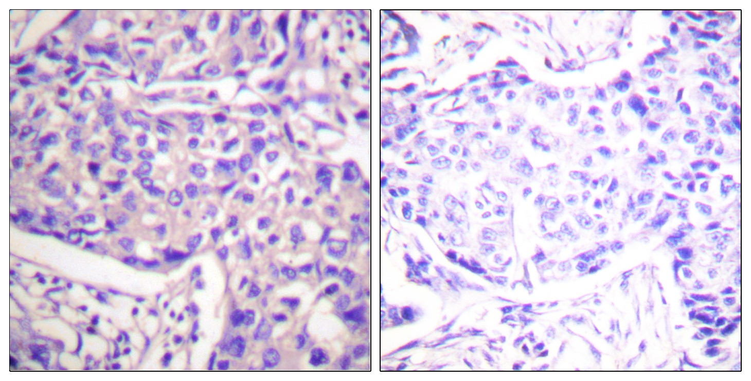 PTEN Polyclonal Antibody