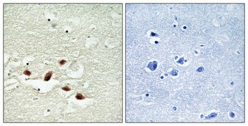 Pdcd-4 Polyclonal Antibody