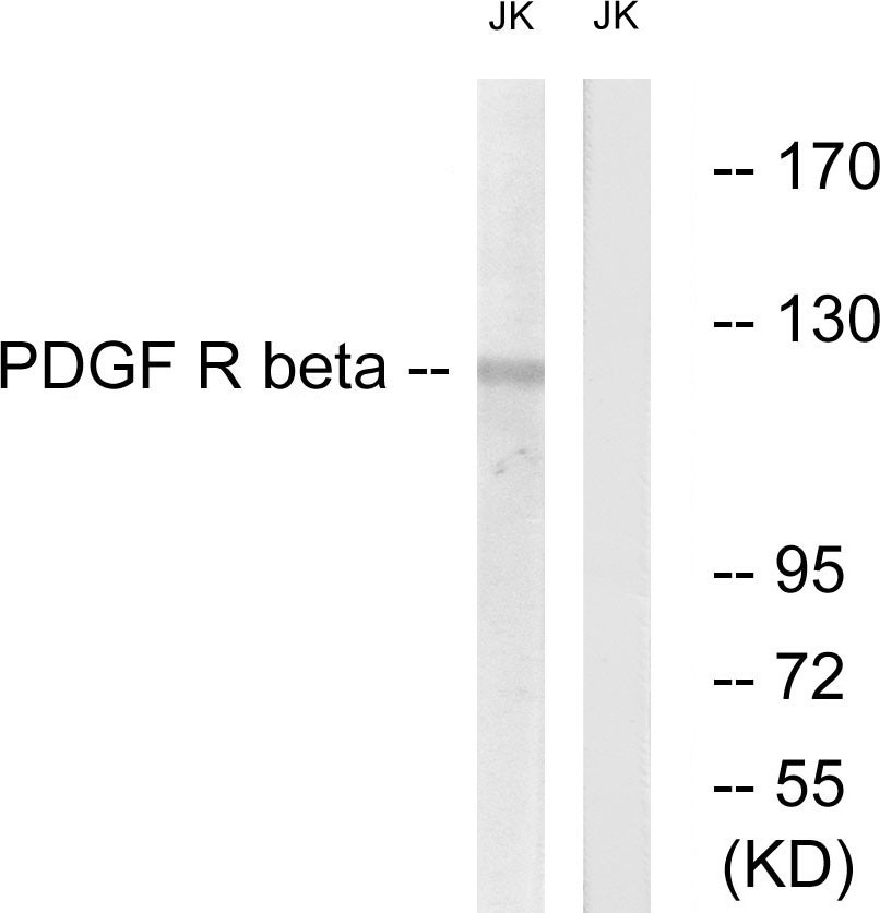 PDGFR-β Polyclonal Antibody