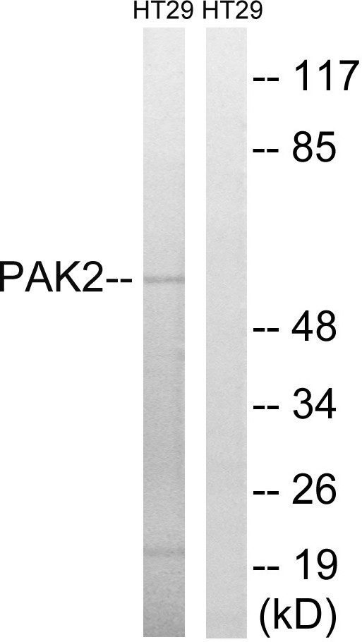 PAKγ Polyclonal Antibody