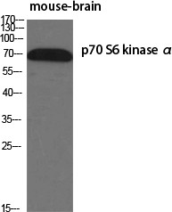 p70 S6 kinase α Polyclonal Antibody