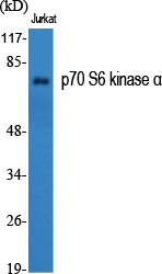 p70 S6 kinase α Polyclonal Antibody