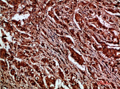 p120 Polyclonal Antibody