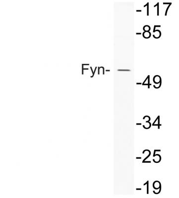 Fyn Polyclonal Antibody