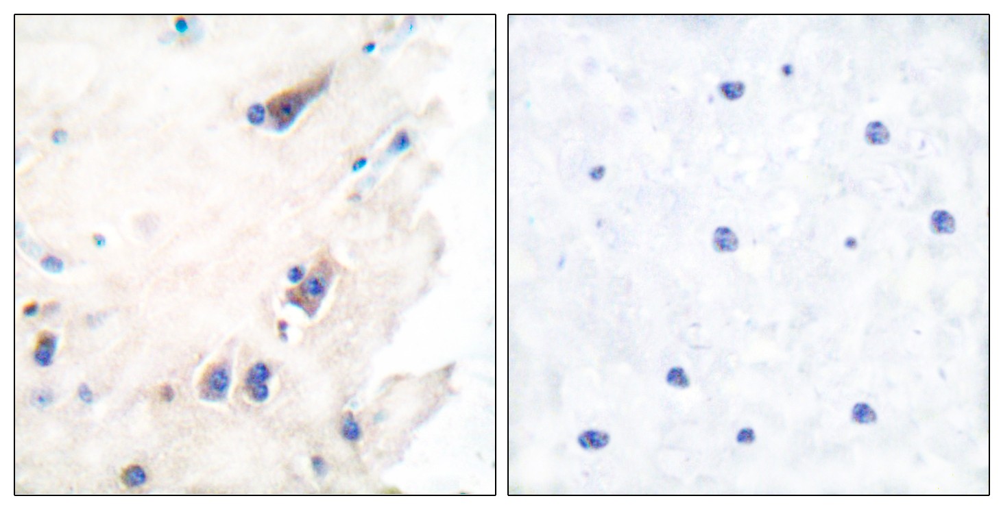 PLC β3 Polyclonal Antibody