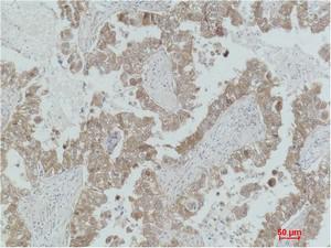 MEK-2 Polyclonal Antibody