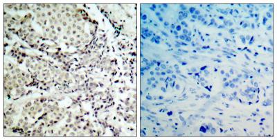 MEK-3 Polyclonal Antibody