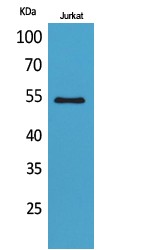 MMP-12 Polyclonal Antibody