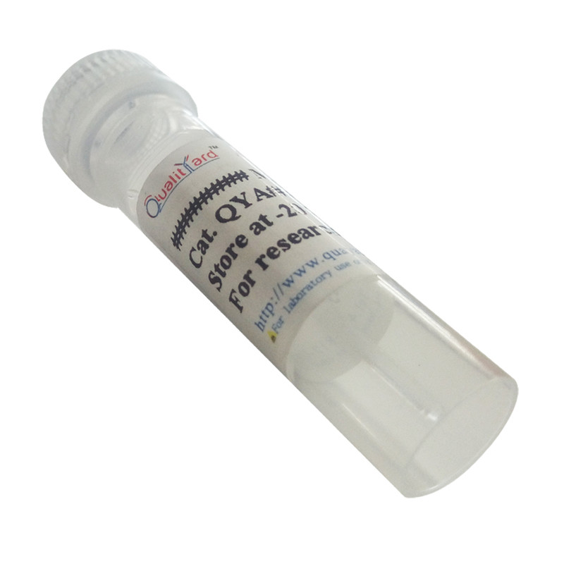 Fibrinogen β Polyclonal Antibody
