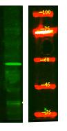 AAA1 Polyclonal Antibody