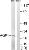 AQP1 Polyclonal Antibody