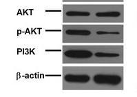 Akt Polyclonal Antibody