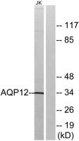 AQP12 Polyclonal Antibody