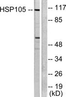 HSP105 Polyclonal Antibody