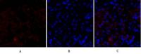 HSP27 Polyclonal Antibody