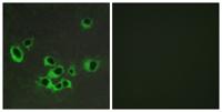 SR-2B Polyclonal Antibody