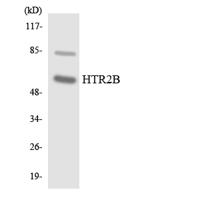 SR-2B Polyclonal Antibody