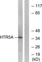 SR-5A Polyclonal Antibody