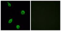 SR-5B Polyclonal Antibody