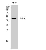 SR-6 Polyclonal Antibody