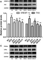 SREBP-1 Polyclonal Antibody