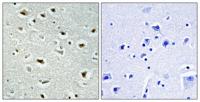 SRE-ZBP Polyclonal Antibody