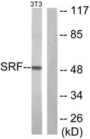 SRF Polyclonal Antibody