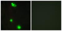 SRp20 Polyclonal Antibody