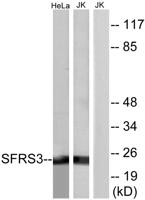 SRp20 Polyclonal Antibody