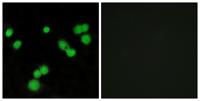 SRp40 Polyclonal Antibody