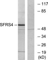 SRp75 Polyclonal Antibody