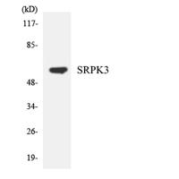 SRPK3 Polyclonal Antibody