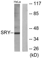 SRY Polyclonal Antibody