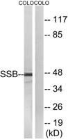 SSB Polyclonal Antibody