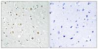 SSBP2 Polyclonal Antibody