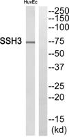 SSH3 Polyclonal Antibody