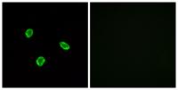 SSTR1 Polyclonal Antibody