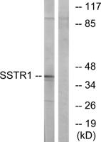 SSTR1 Polyclonal Antibody