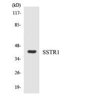 SSTR1 Polyclonal Antibody